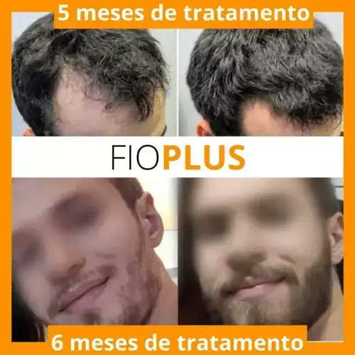 FIOPLUS®