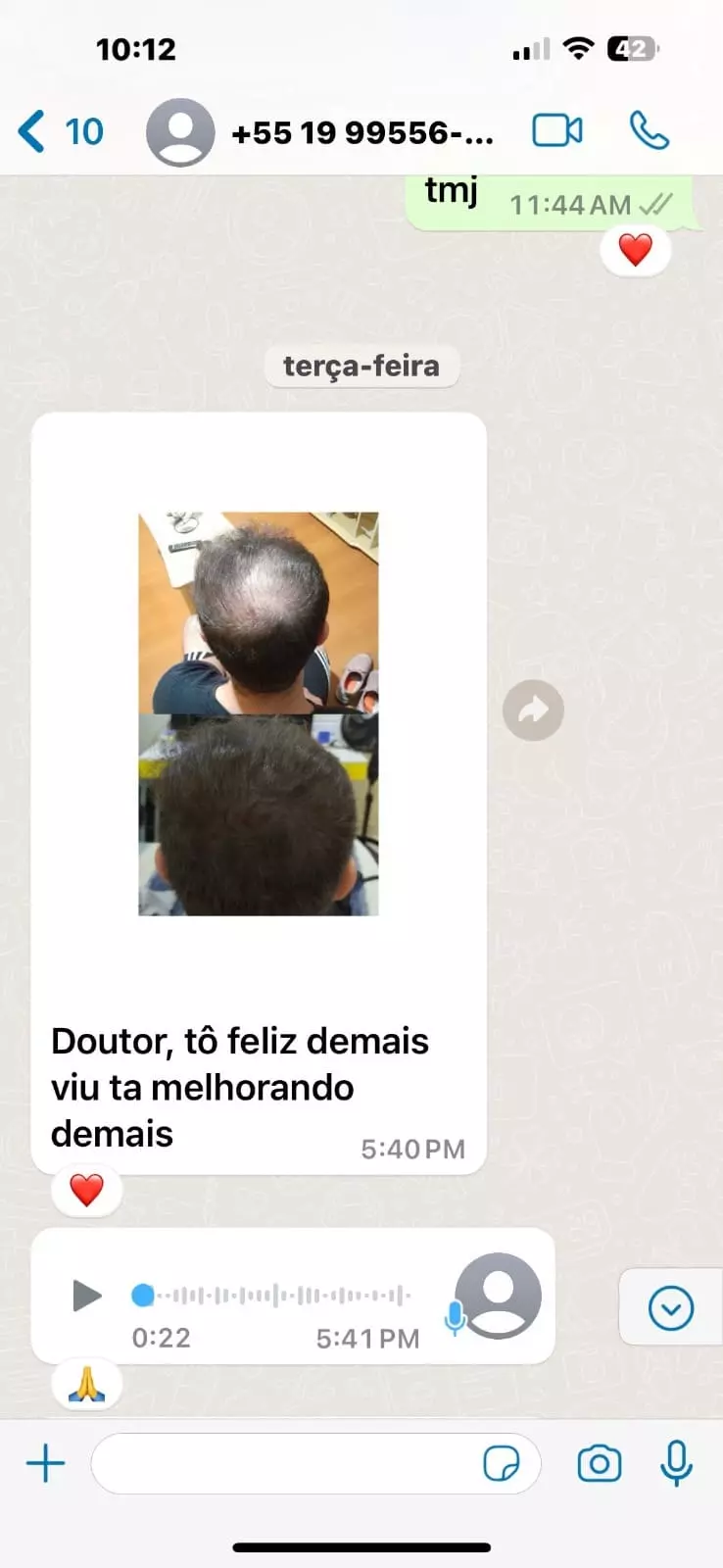 .